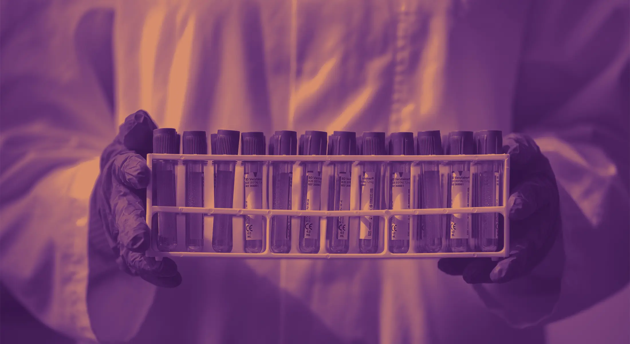 Gehandschoende laboratoriummedewerker houdt een rek met samplebuizen vast.