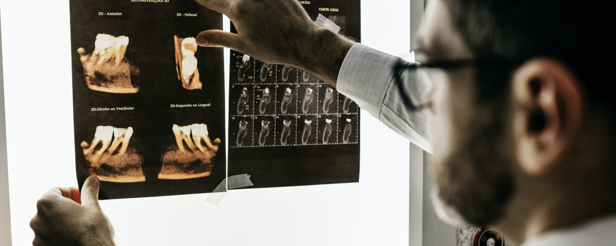 AI MRI Scans